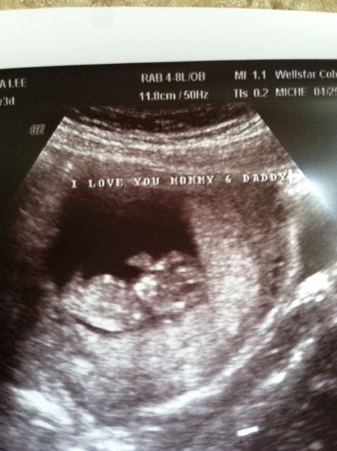 230741_10100428322175770_4904147_61808657_1511519_n